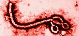 ebola_micrograph_virus-afrique1