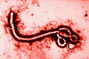ebola_micrograph_virus-afrique1