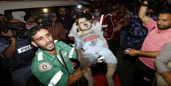 A Palestinian doctor holds the dead body of a baby girl following an Israeli airstrike on a house in Gaza City on August 19, 2014.
